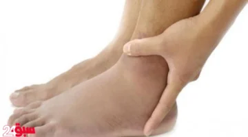 زيادة الأملاح بالجسم.. أعراض خطيرة تنذرك بالخطر وعلاجات منزلية بسيطة وفعالة